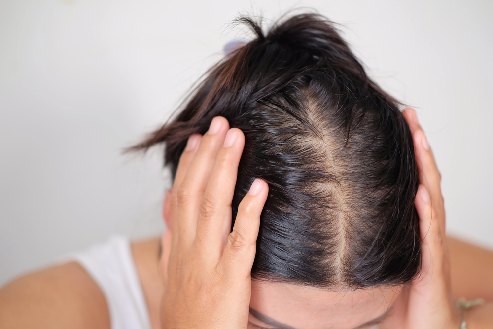 Причины выпадения волос у женщин после 30