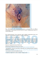 Учебные материалы по программе Методы коррекции в эстетической гинекологии в Магадане