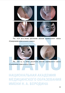Учебные материалы по программе Послеродовая хирургическая эндоскопия в Москве