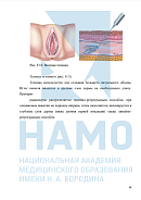 Учебные материалы по программе Инъекционные методики в гинекологии в Санкт-Петербурге