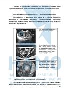 Учебные материалы по программе Медикаментозное прерывание беременности в Севастополе