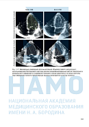 Учебные материалы по программе Медико-социальная экспертиза при сердечно-сосудистых заболеваниях в Екатеринбурге
