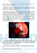 Учебные материалы по программе Лапароскопия и гистероскопия в оперативной гинекологии в Екатеринбурге