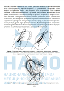 Учебные материалы по программе Диагностика и лечение острых гастродуоденальных кровотечений в Санкт-Петербурге