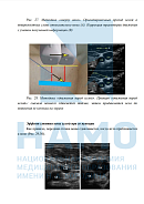 Учебные материалы по программе Ультразвуковая навигация в анестезиологии и интенсивной терапии в Москве